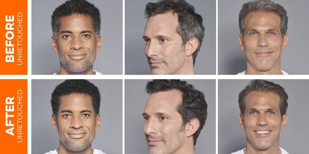 Image Before After One Twist